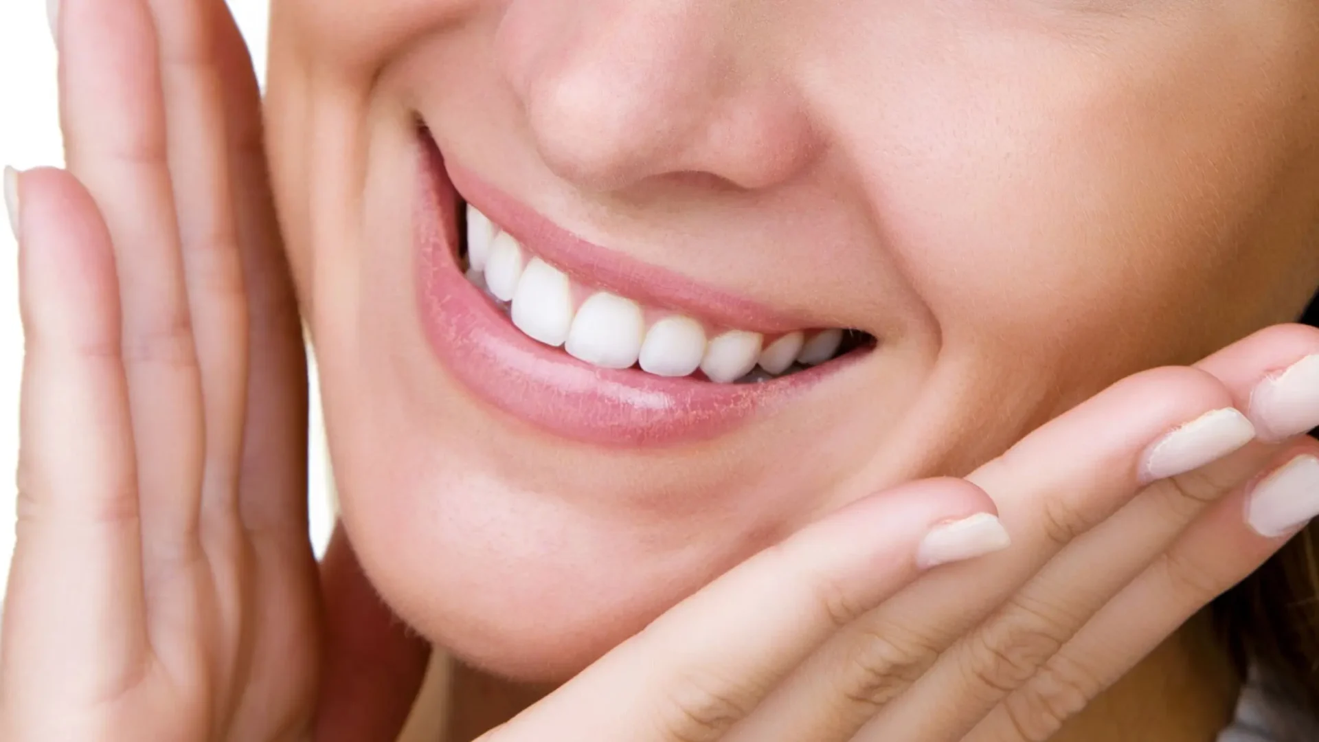 Sonrisa con un blanco radiante tras someterse a un blanqueamiento dental