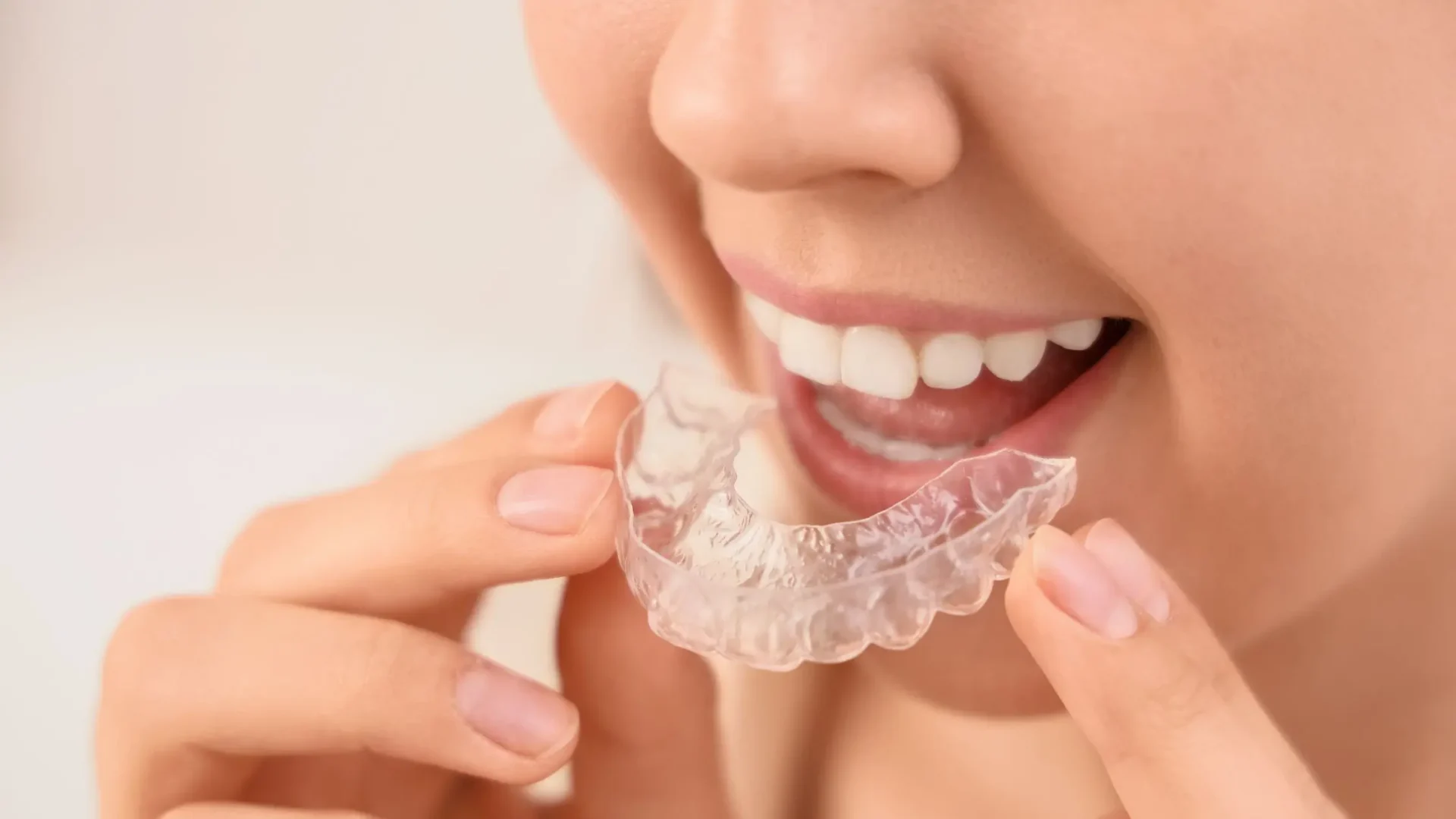 Imagen de una mujer colocándose una férula para descansar la dentadura y no empeorar el bruxismo