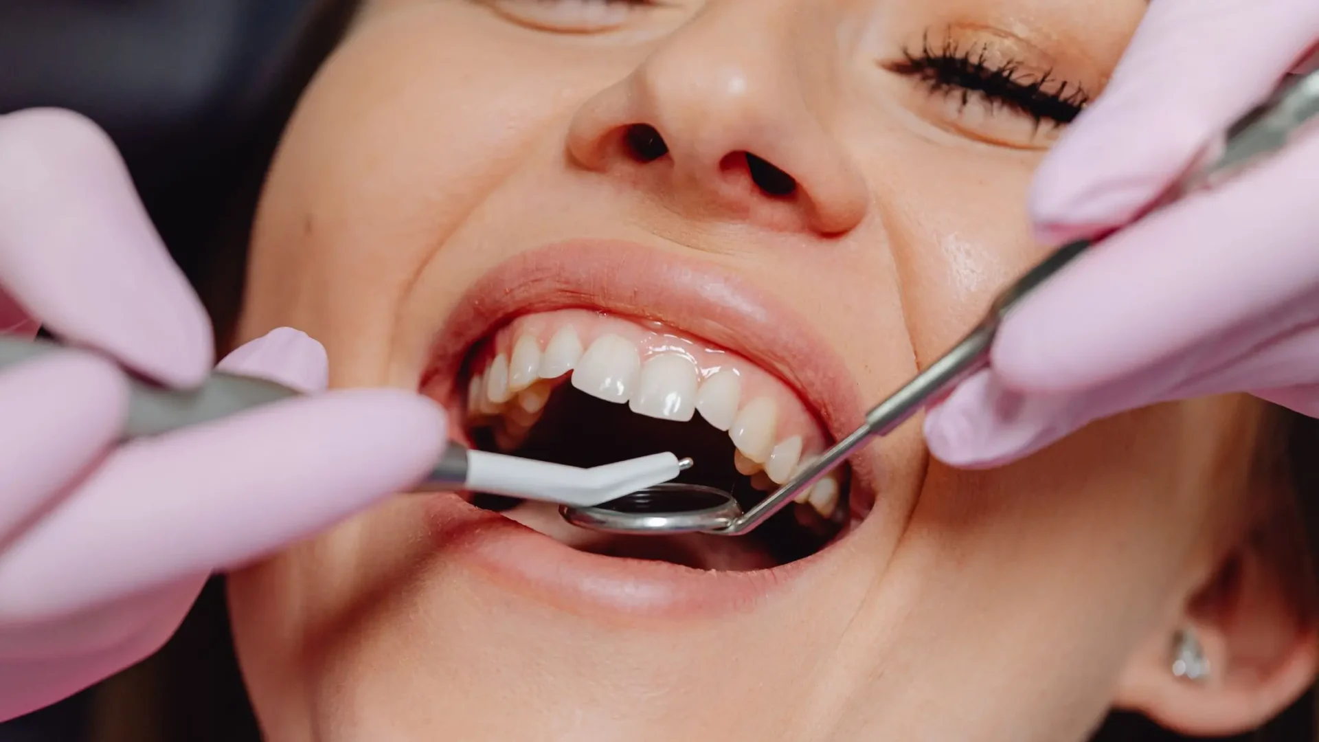 Mujer tratándose del sarro dental en el dentista