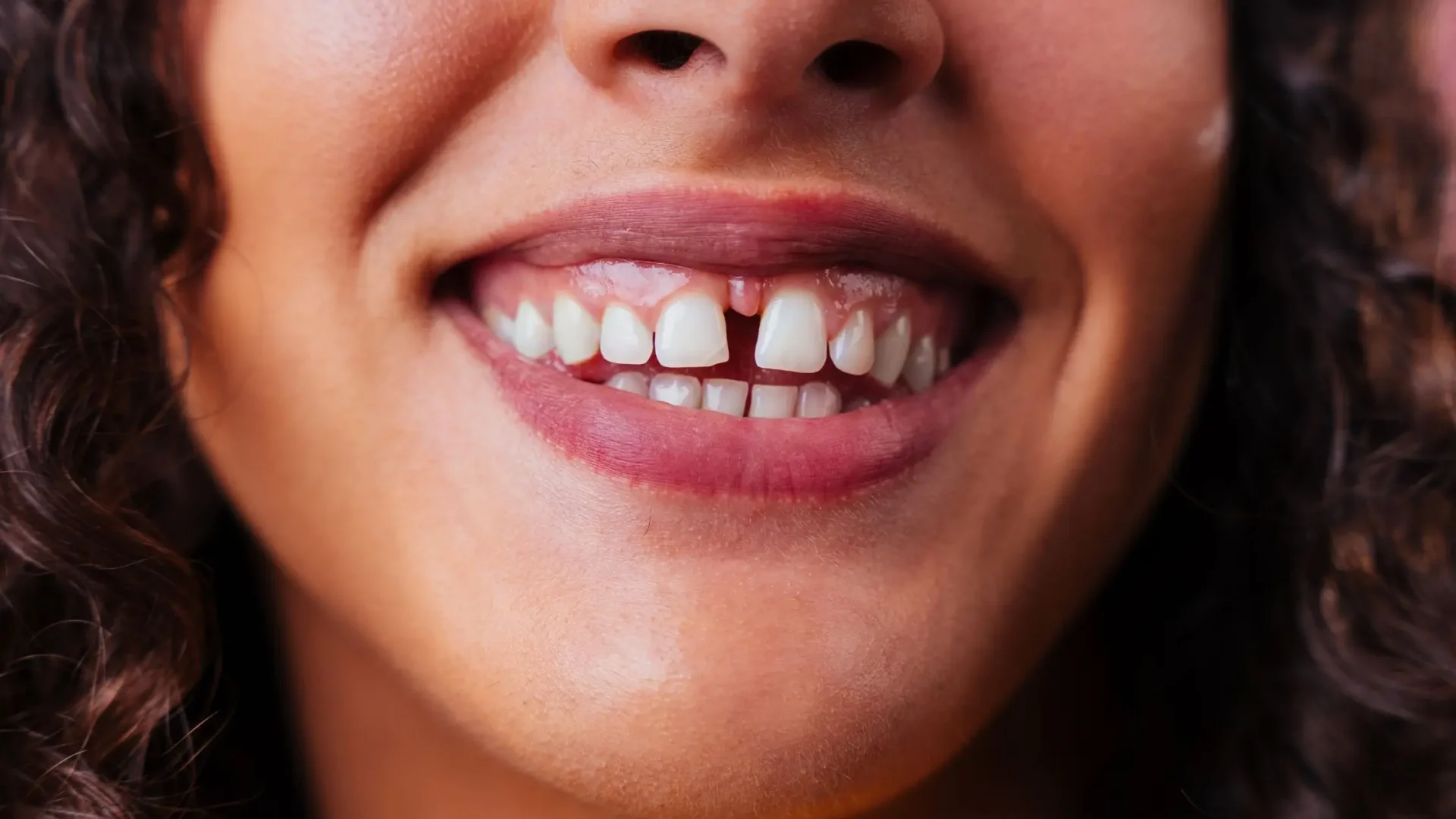 clínica dental en málaga